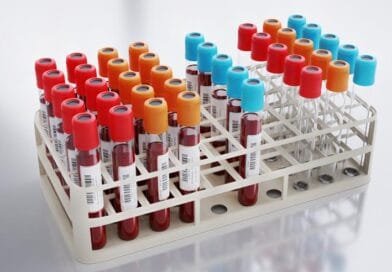 Junho Laranja: Incidência entre os homens com leucemia é 20% maior do que entre as mulheres