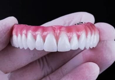Dentadura ainda é coisa de avó? Especialista explica como as próteses mudaram e quando elas são indicadas